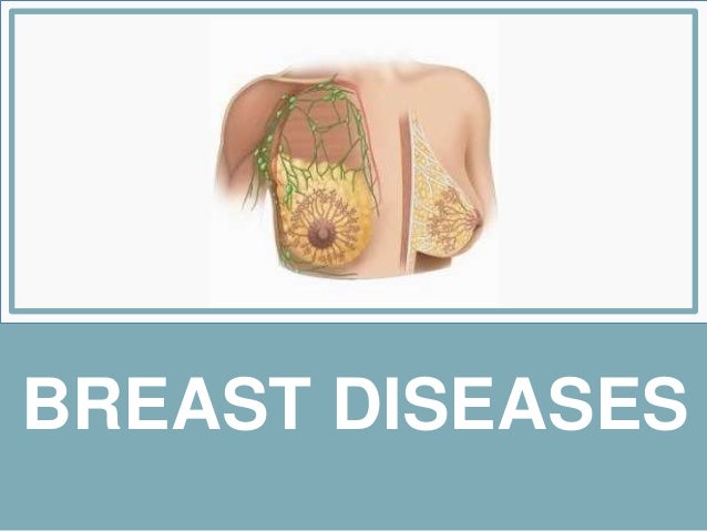 malignant breast diseases Some sex education